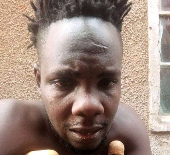 Omukunja Atesera unmasked for faking kidnap and torture allegations